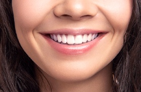 close-up of beautiful smile after gum contouring in Woodbridge
