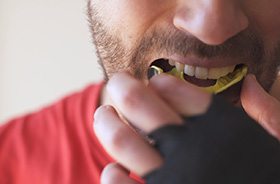 Athlete placing mouthguard in his mouth