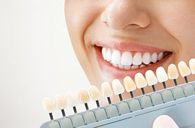 Dentist holding shade guide next to patient’s teeth